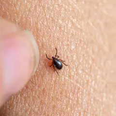 Gros plan d'une tique sur la peau, près d'un doigt. Une tique dans la maison peut être une surprise désagréable.