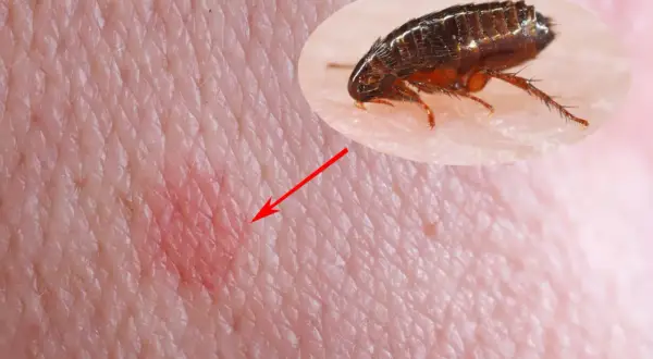 Gros plan d'une piqûre de puce de chien sur la peau humaine, avec une puce agrandie pointée par une flèche rouge.