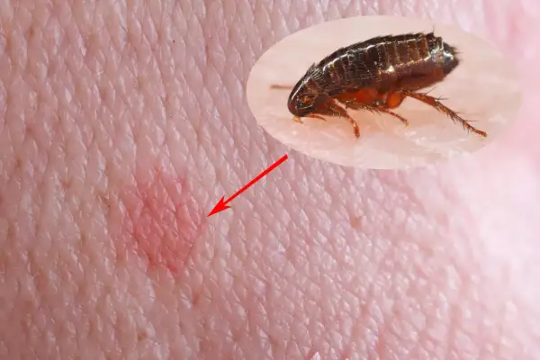 Gros plan d'une piqûre de puce de chien sur la peau humaine, avec une puce agrandie pointée par une flèche rouge.